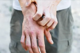 3tSpEuYWKEyxvI8tWw3mOg