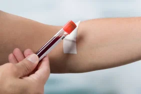 depositphotos_182993440-stock-photo-hand-holding-blood-probe-in