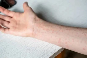 e588ab0b-9715-401e-811f-76969dcc1e2c