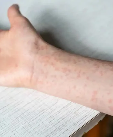 e588ab0b-9715-401e-811f-76969dcc1e2c