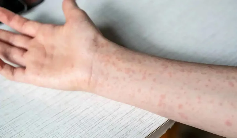 e588ab0b-9715-401e-811f-76969dcc1e2c